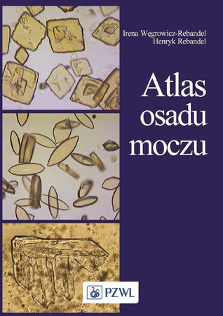 Atlas osadu moczu