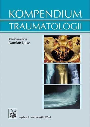 Kompendium traumatologii PZWL