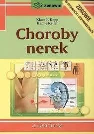 Choroby nerek