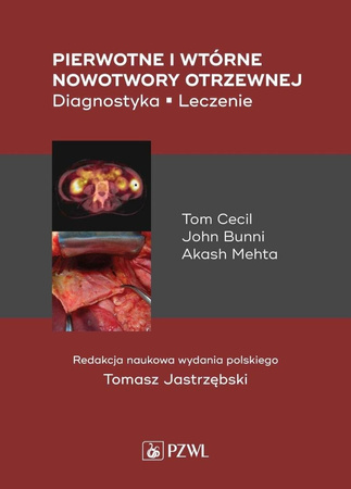 Pierwotne i wtórne nowotwory otrzewnej. Diagnostyk