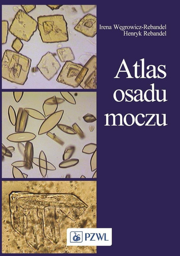 Atlas osadu moczu